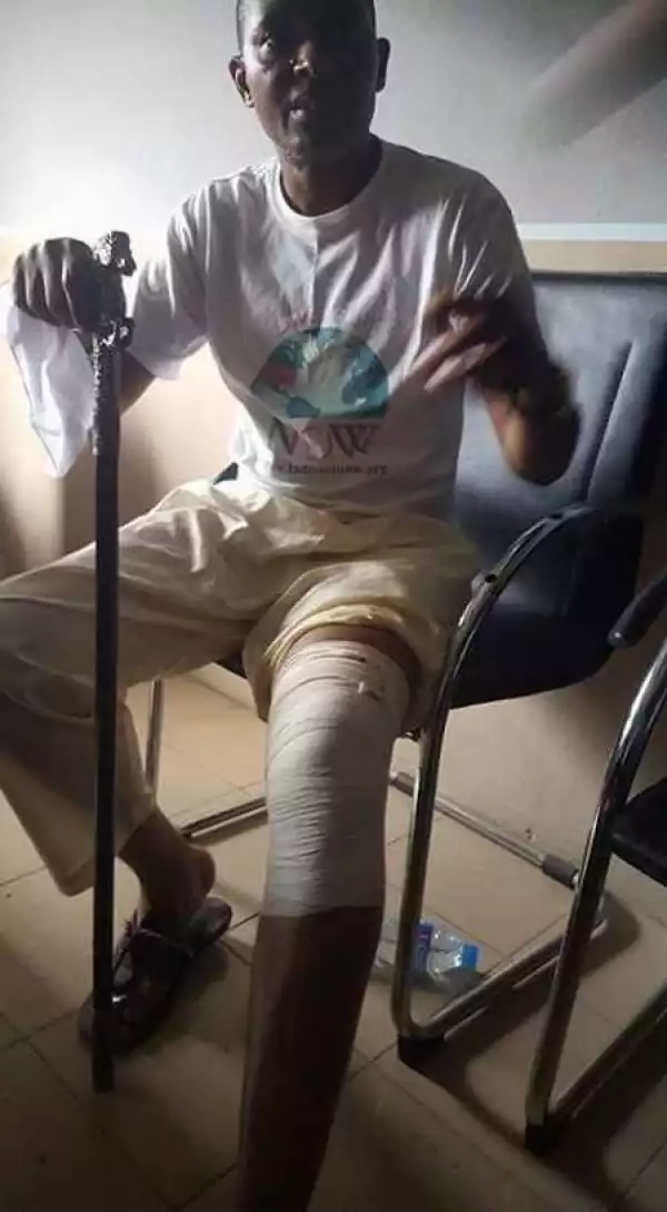 Meet Apostle Weeks Whose Building Collapsed Killing Many in Uyo, His Leg May Be Amputated (Photo)